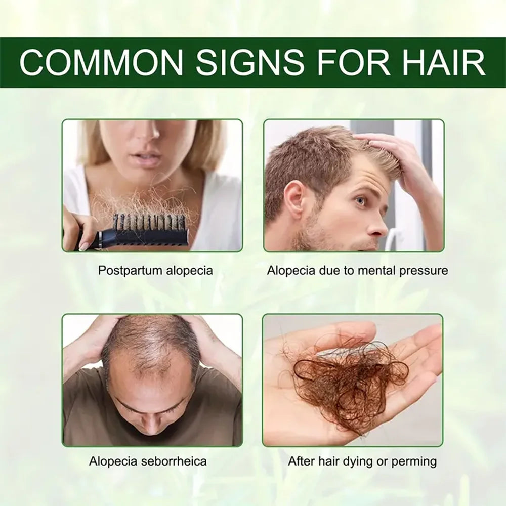 Rosemary Mint Hair Growth Oil with Biotin – Scalp Strengthening & Hair Loss Treatment