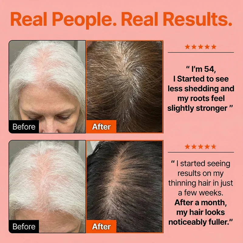 Hair Growth Serum with Built-In Brush Heartleaf Exosome Scalp Serum